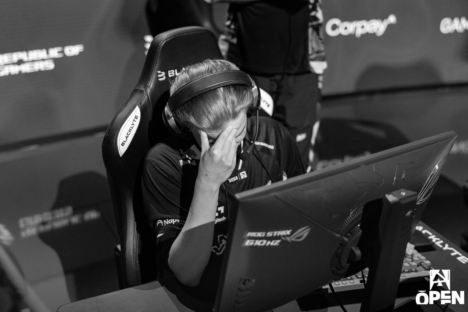 AleksiB in black and white with hand on his forehead.